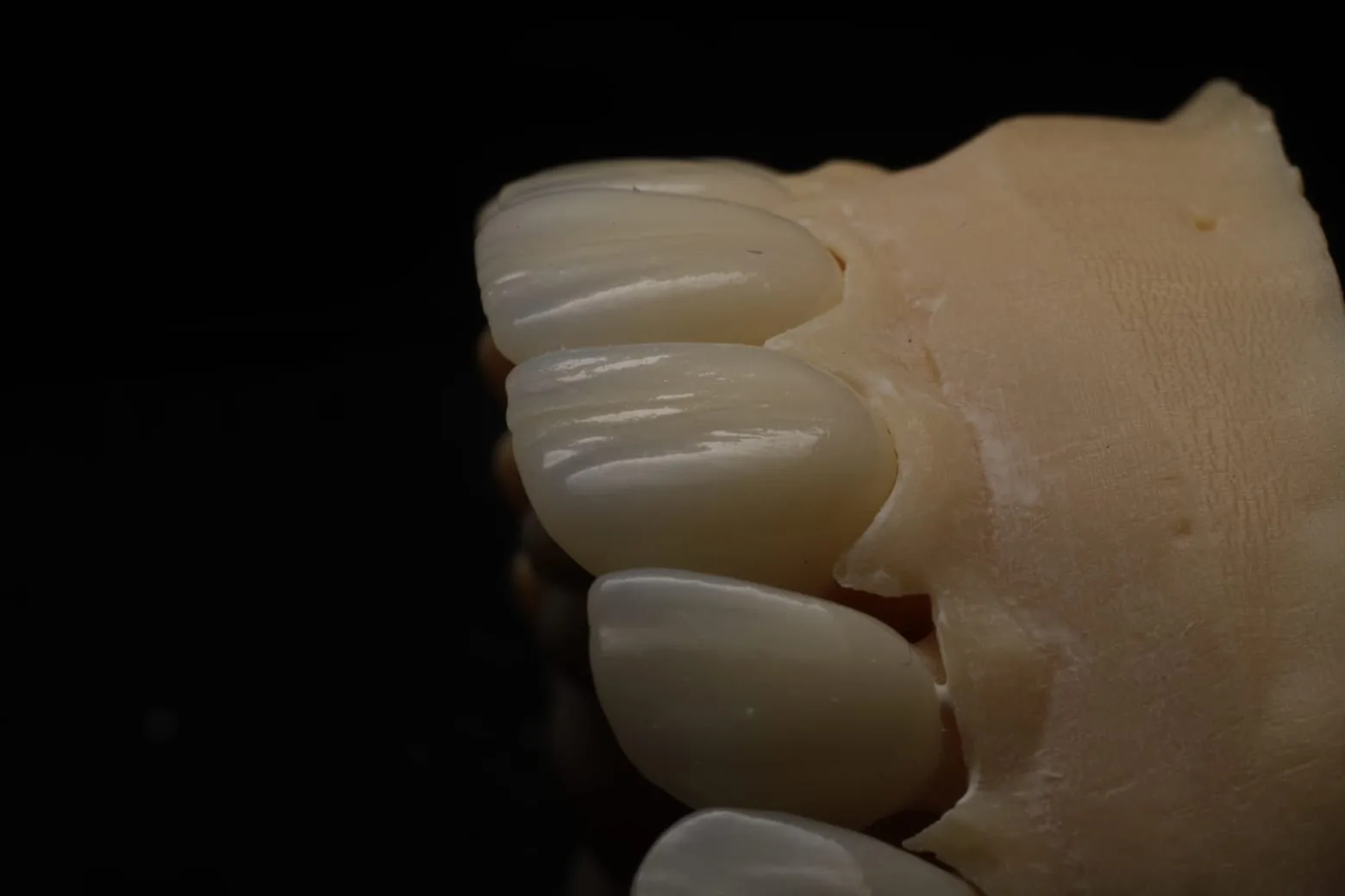 Iris Dental Lab 1