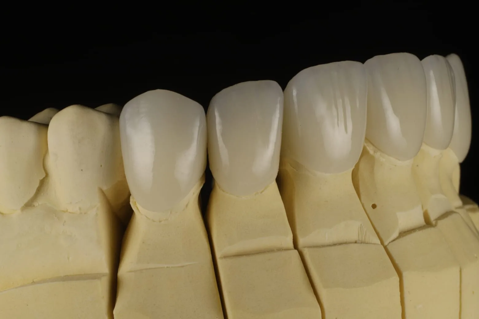 Iris Dental Lab 2