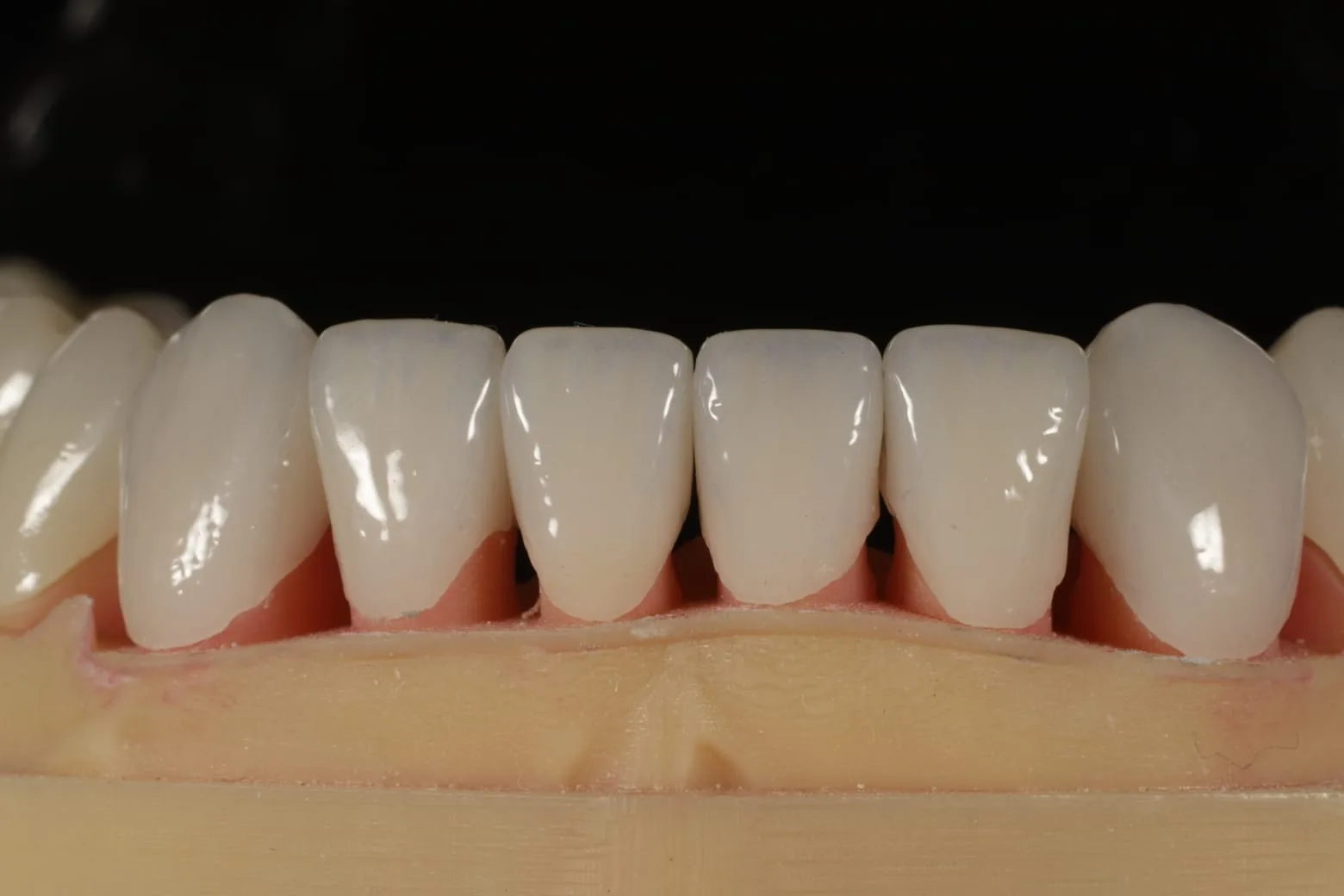 Iris Dental Lab 3