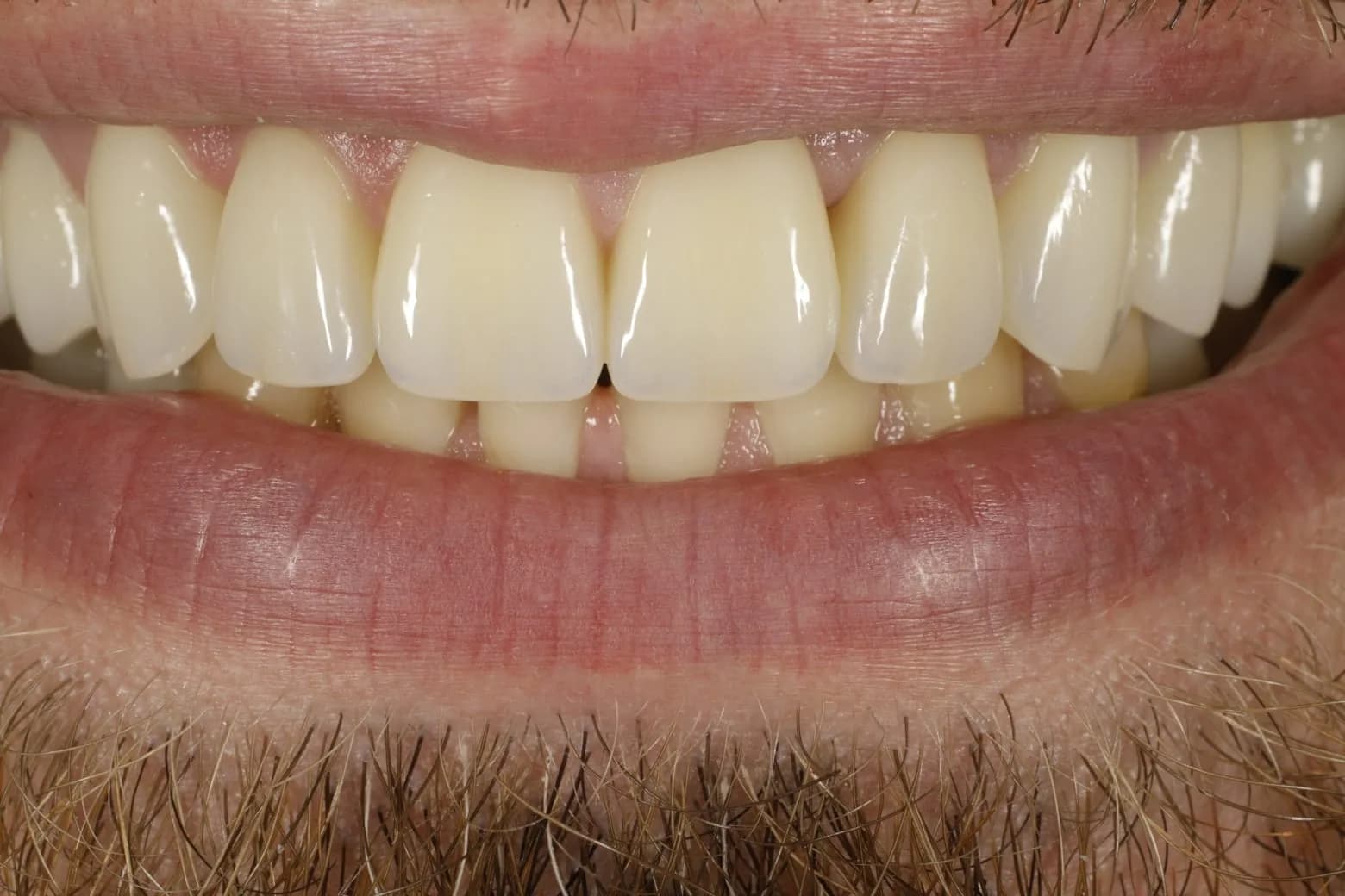 Iris Dental Lab 6