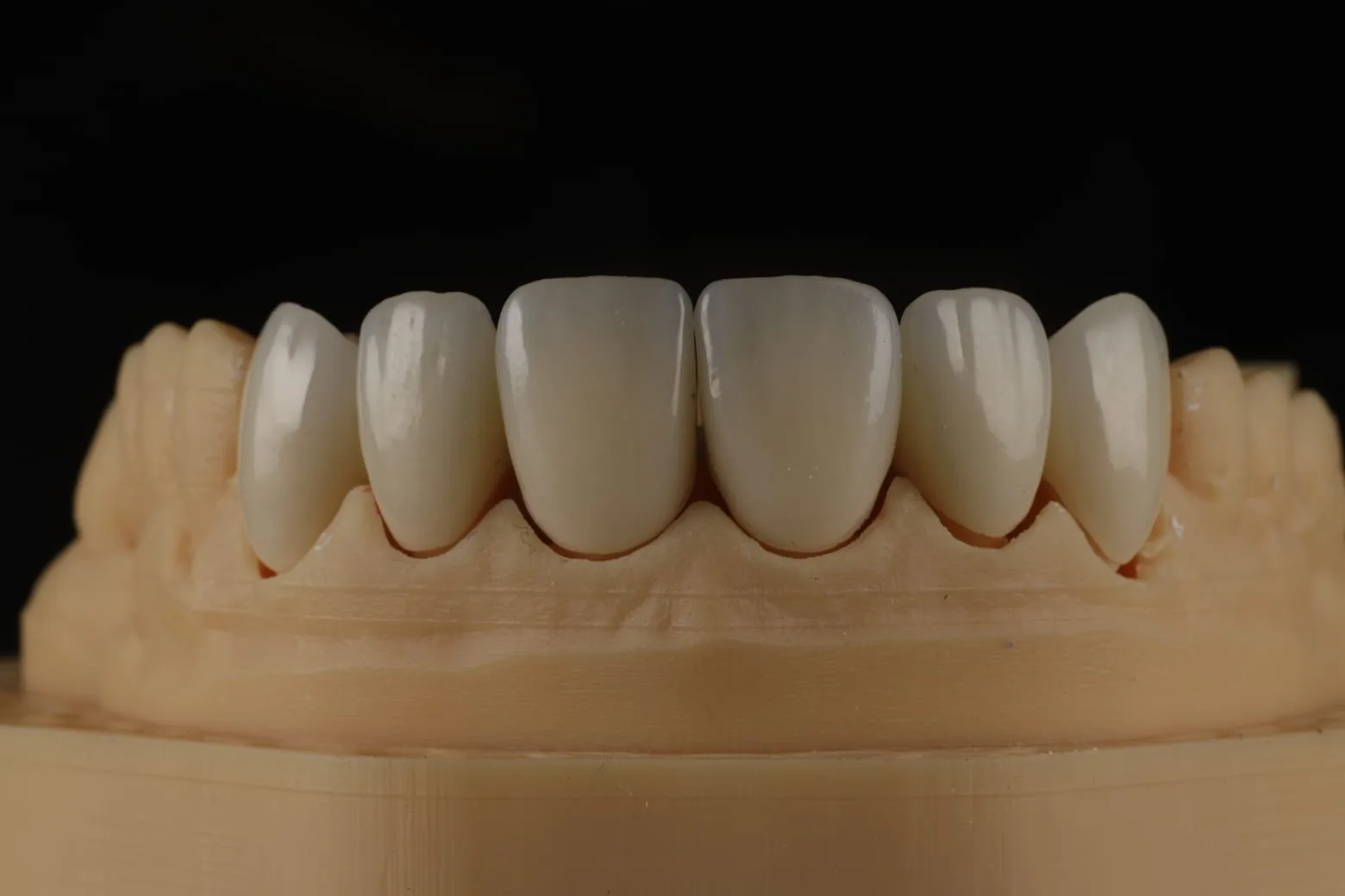 Iris Dental Lab 7