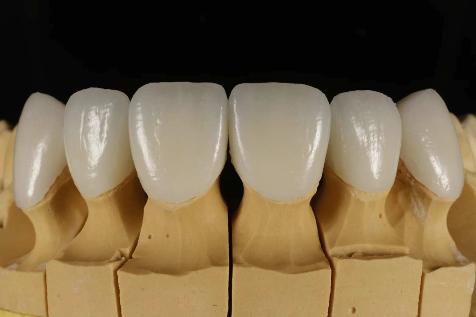 Iris Dental Lab 8