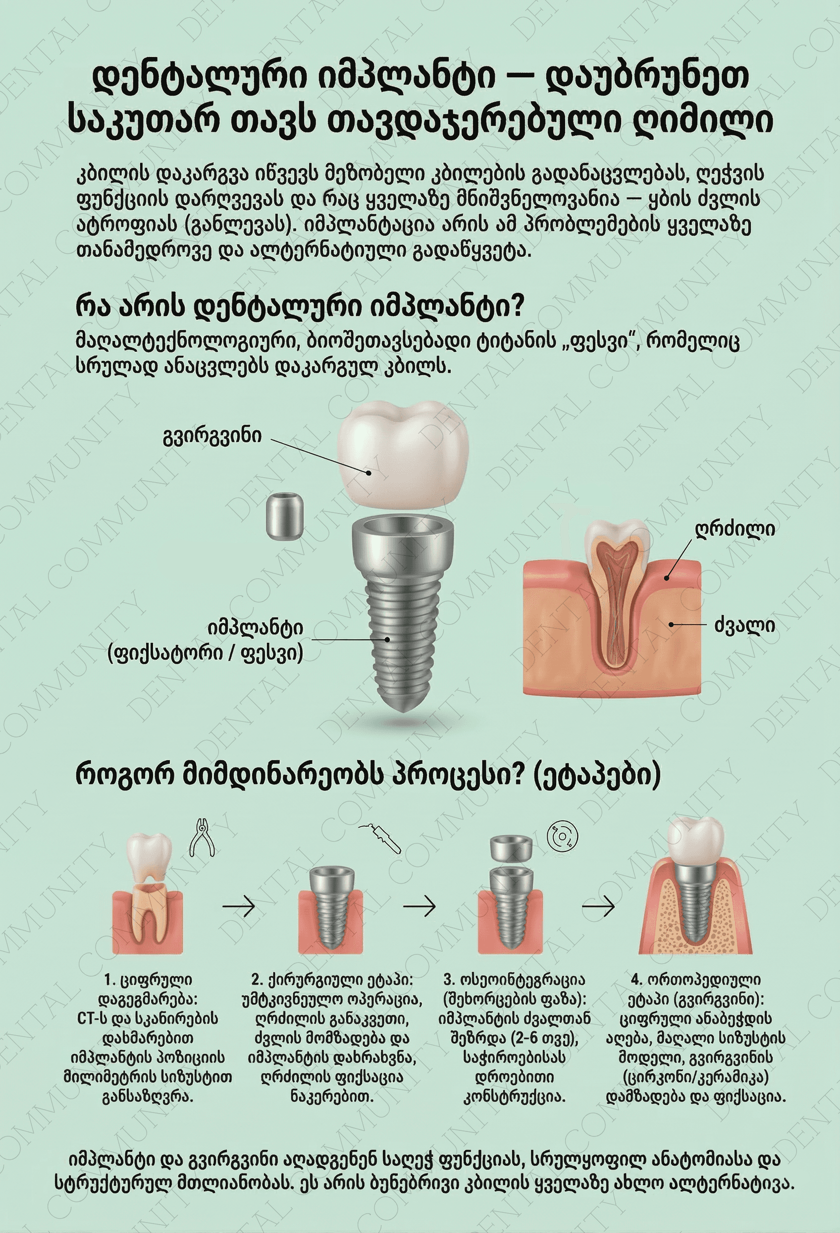 Dental Implant - 1