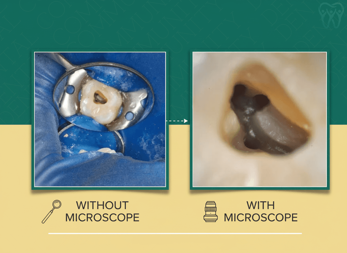 Dental Microscope: The Gold Standard That Changes Treatment Quality Forever - 2